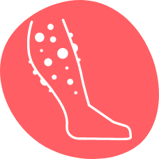 Röd cirkel vitt den med knölar på